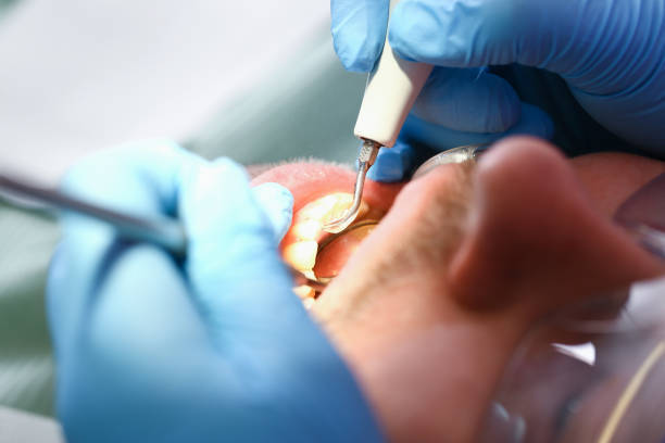 Best Emergency Dental Surgery in Bluefield, WV
