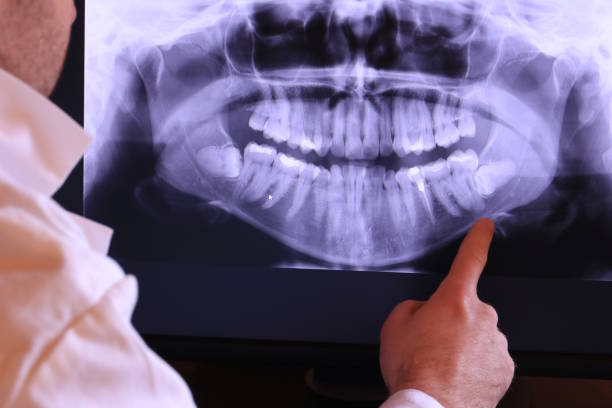 Best Emergency Broken Tooth Repair in Bluefield, WV