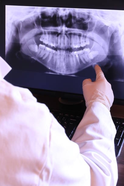Best Emergency Treatment for Toothache in Bluefield, WV